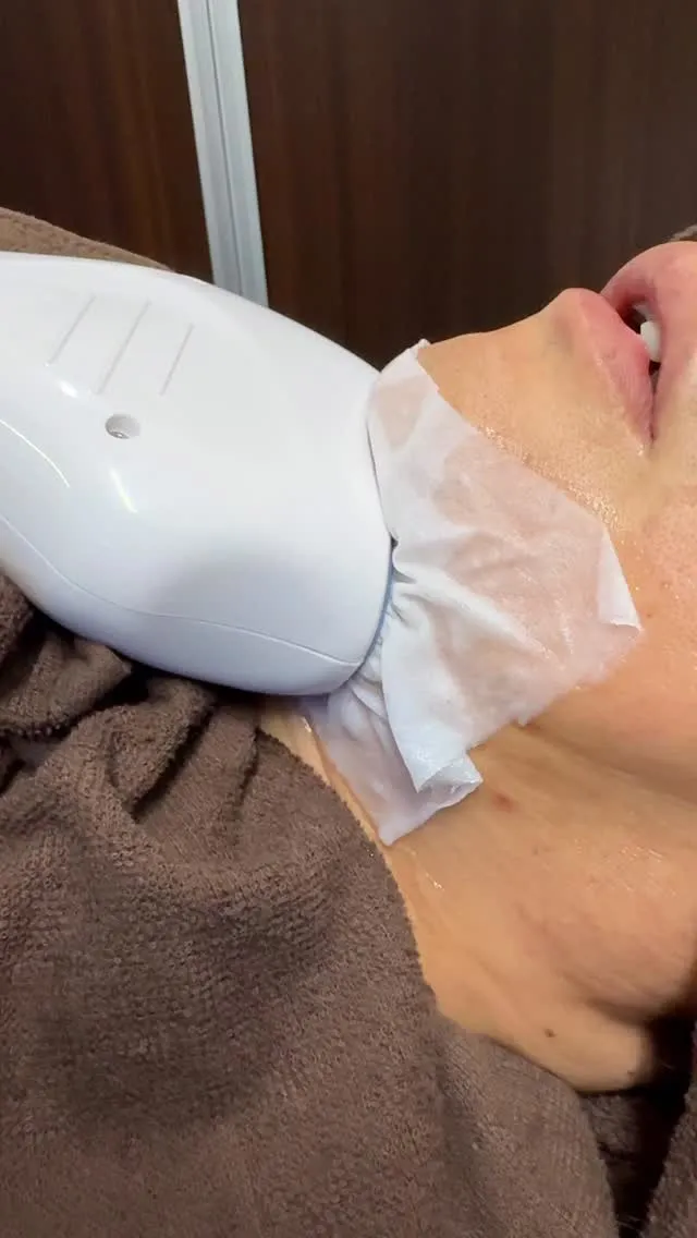 【脂肪冷却〈顎下〉❄️】